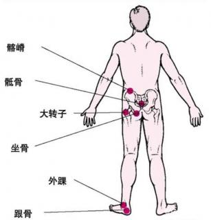 压疮的预防与护理